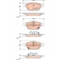 TRW GDB3476
